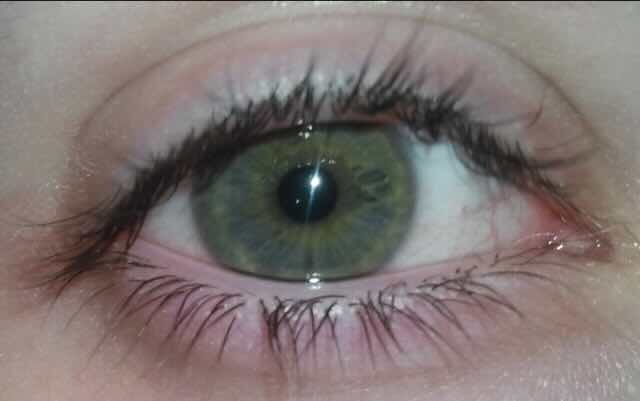My right eye